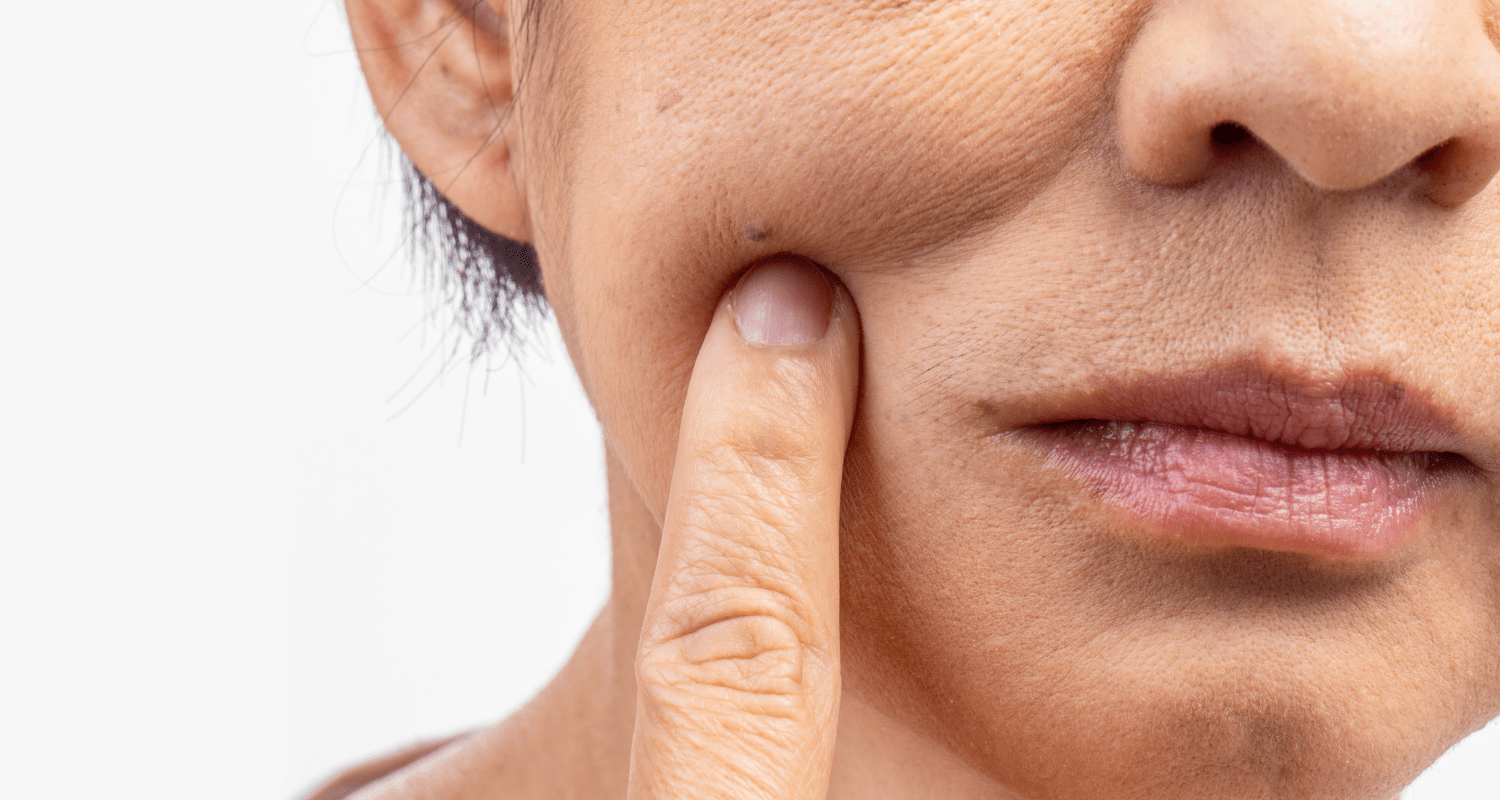 Dry Skin vs. Dehydrated Skin: How To Tell The Difference - Skin Alchemy