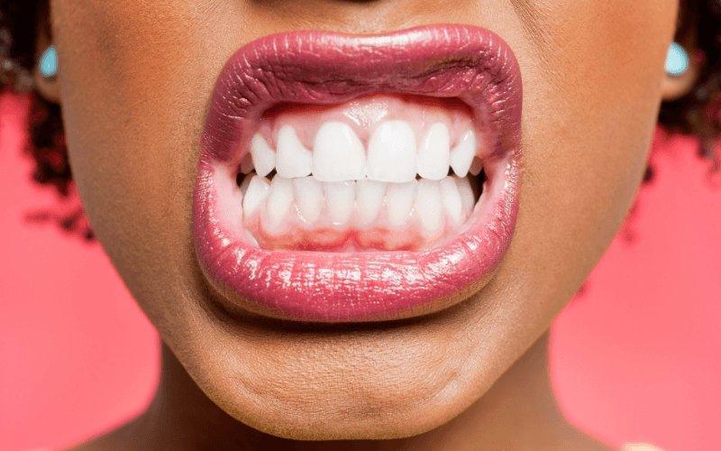 Oil Pulling: Health Benefits & How To - Skin Alchemy