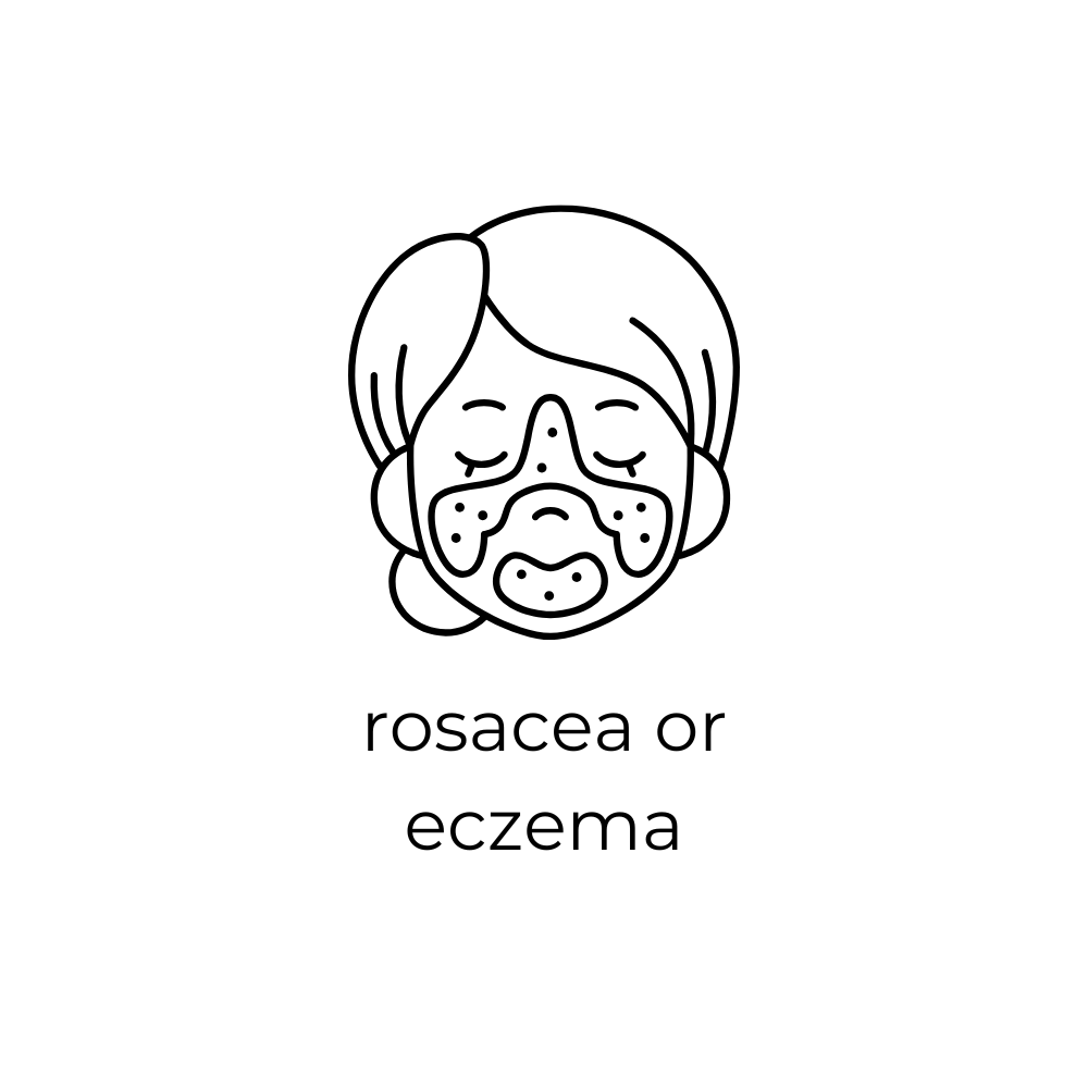 rosacea or eczema